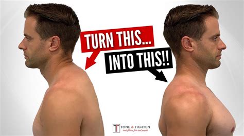How to get rid of neck hump - How to Get Rid of a Neck Hump (5 Exercises for a Total Posture Makeover) Posture Makeover 192K subscribers Subscribe Subscribed 167K 6.9M views 6 years ago …
